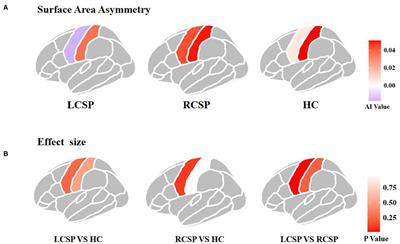 Structural and Functional Asymmetry in Precentral and Postcentral Gyrus in Patients With Unilateral Chronic Shoulder Pain